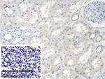 SMN2 Antibody in Immunohistochemistry (Paraffin) (IHC (P))