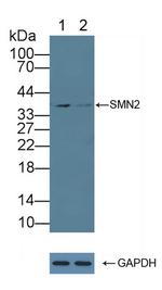 SMN2 Antibody in Western Blot (WB)