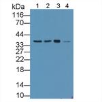 SMN2 Antibody in Western Blot (WB)