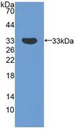 SMN2 Antibody in Western Blot (WB)