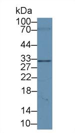 Syntenin 1 Antibody in Western Blot (WB)
