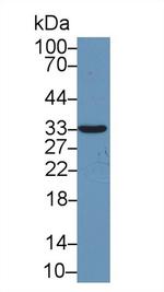Syntenin 1 Antibody in Western Blot (WB)
