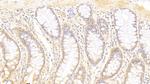 Syntenin 2 Antibody in Immunohistochemistry (Paraffin) (IHC (P))