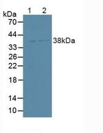 Syntenin 2 Antibody in Western Blot (WB)