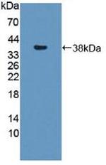 SNTB1 Antibody in Western Blot (WB)