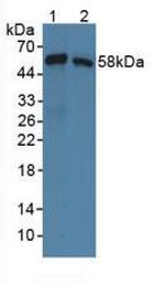 SNTB1 Antibody in Western Blot (WB)