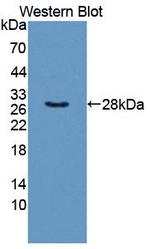 TXLNA Antibody in Western Blot (WB)