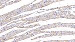Tenascin C Polyclonal Antibody