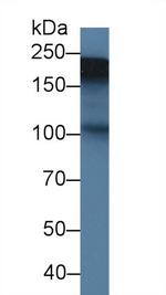 Tenascin C Antibody in Western Blot (WB)