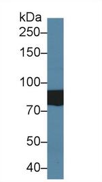 SLC26A8 Antibody in Western Blot (WB)