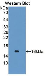 TSPAN1 Antibody in Western Blot (WB)