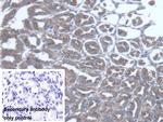 TST Polyclonal Antibody