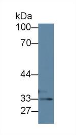TST Antibody in Western Blot (WB)