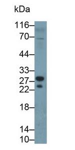 TK1 Antibody in Western Blot (WB)