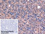 Thymidylate Synthase Antibody in Immunohistochemistry (Paraffin) (IHC (P))