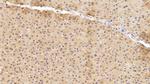 SERPINA7 Antibody in Immunohistochemistry (Paraffin) (IHC (P))