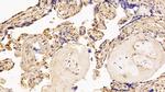 SERPINA7 Antibody in Immunohistochemistry (Paraffin) (IHC (P))