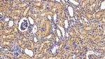 SERPINA7 Antibody in Immunohistochemistry (Paraffin) (IHC (P))