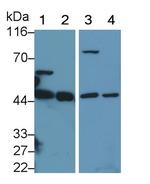 TSTA3 Antibody in Western Blot (WB)