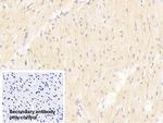 TRAF6 Polyclonal Antibody