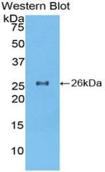 TOR2A Antibody in Western Blot (WB)