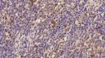 TGM2 Antibody in Immunohistochemistry (Paraffin) (IHC (P))