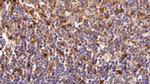 TGM2 Antibody in Immunohistochemistry (Paraffin) (IHC (P))