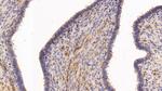 TGM2 Antibody in Immunohistochemistry (Paraffin) (IHC (P))