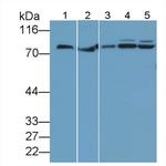 TGM2 Antibody in Western Blot (WB)