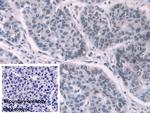 Transketolase Antibody in Immunohistochemistry (Paraffin) (IHC (P))