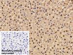 Transketolase Antibody in Immunohistochemistry (Paraffin) (IHC (P))