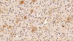Transketolase Antibody in Immunohistochemistry (Paraffin) (IHC (P))
