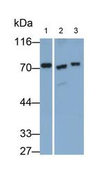 Transketolase Antibody in Western Blot (WB)