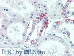 TMEM27 Antibody in Immunohistochemistry (Paraffin) (IHC (P))