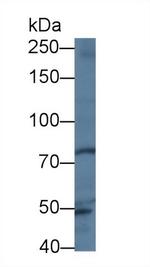 Trophinin Antibody in Western Blot (WB)