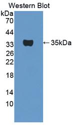 TPSB2 Antibody in Western Blot (WB)