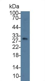 TPSB2 Antibody in Western Blot (WB)