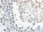 TPSB2 Antibody in Immunohistochemistry (Paraffin) (IHC (P))