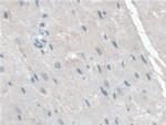 TPSB2 Antibody in Immunohistochemistry (Paraffin) (IHC (P))