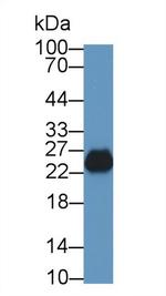 TPSB2 Antibody in Western Blot (WB)