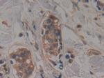 TTK Antibody in Immunohistochemistry (Paraffin) (IHC (P))