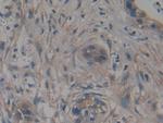 TTK Antibody in Immunohistochemistry (Paraffin) (IHC (P))