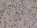 TTK Antibody in Immunohistochemistry (Paraffin) (IHC (P))
