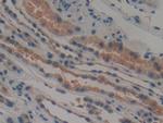 TTK Antibody in Immunohistochemistry (Paraffin) (IHC (P))