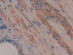 TTK Antibody in Immunohistochemistry (Paraffin) (IHC (P))