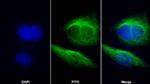 TUBB1 Antibody in Immunocytochemistry (ICC/IF)