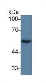 TUBB1 Antibody in Western Blot (WB)