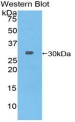 TUBB6 Antibody in Western Blot (WB)