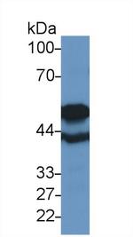 TUBB6 Antibody in Western Blot (WB)