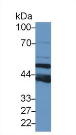 TUBB6 Antibody in Western Blot (WB)